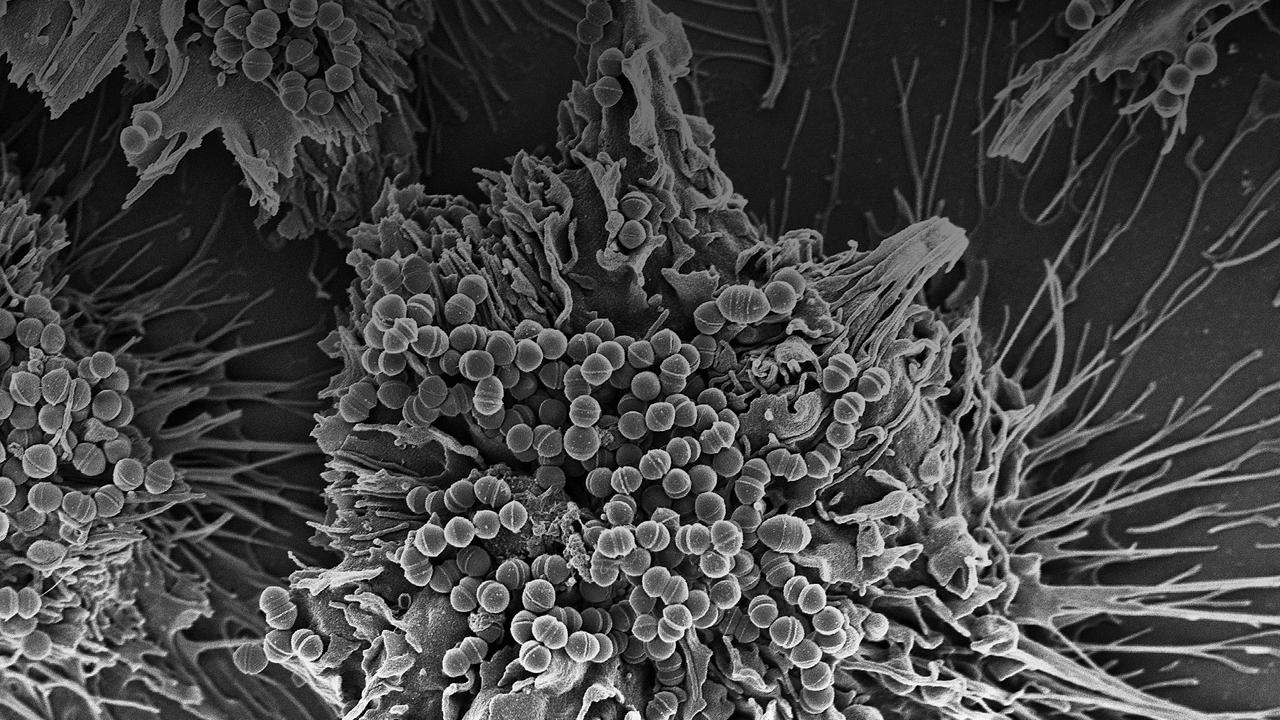 Вы больны не мной